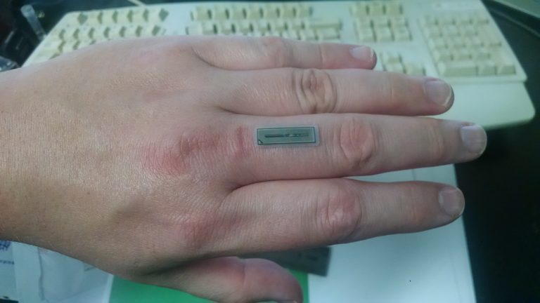 NFC Hochleistungsimplantat flexNT