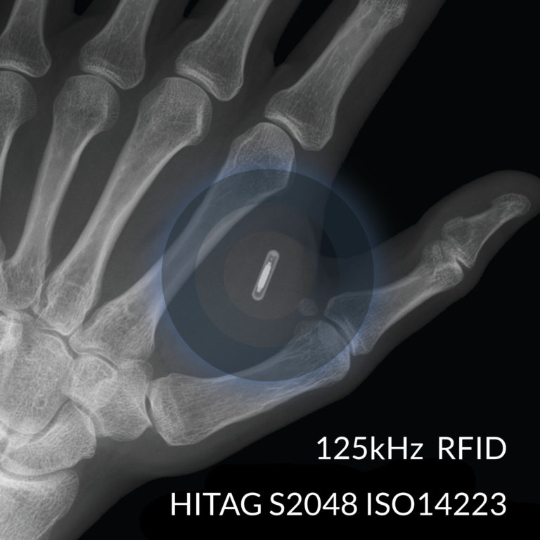 xHT HITAG Implantat