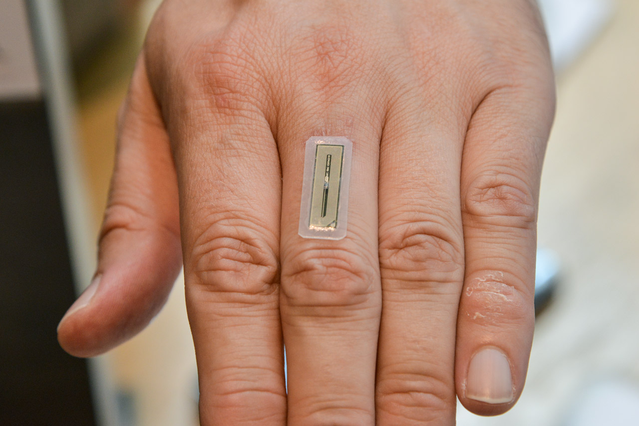 NFC Hochleistungsimplantat flexNT