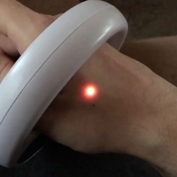 xLED Implant - "let it glow"